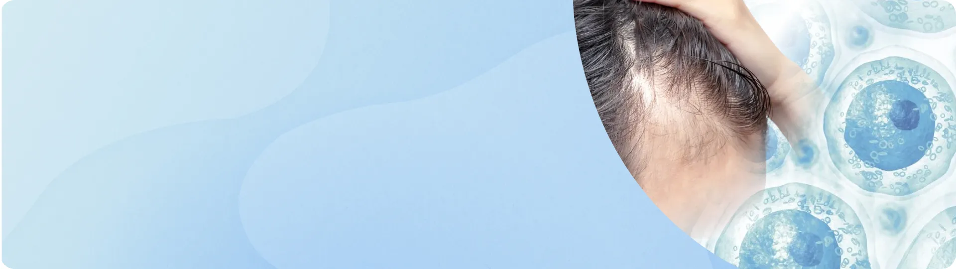 Regenerative Hair Restoration | Stem Cell Hair Regrowth – Tokyo